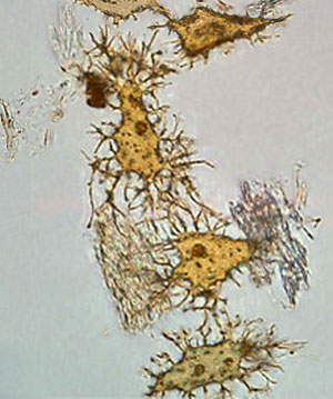 Dinosaur-bone-cells.jpg